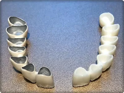 Metal Destekli Kaplama